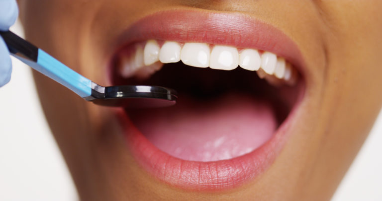 Całościowe leczenie stomatologiczne – odkryj trasę do zdrowego i pięknego uśmiechów.